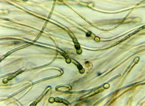 GLOEOTRICHIA Algae